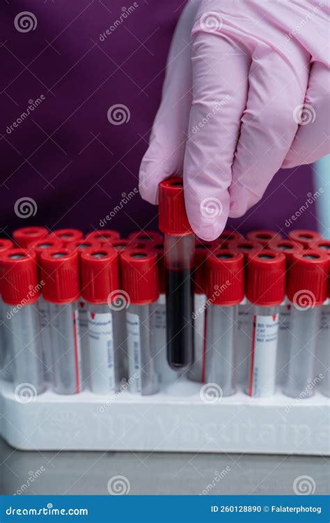 vials and bottles test|needle to vial blood work.